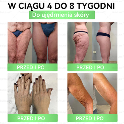 A♻️𝖮𝖋𝗶𝗰𝗷𝗮𝗹𝗻𝘆 𝘀𝗸𝗹𝗲𝗽 | 👩‍⚕️𝘽𝙪𝙞𝙡𝙙𝙇𝙚𝙖𝙛® 𝗚𝗟𝗣-𝟭 𝟖-w-𝟭 Smukły i zdrowy roztwór doustny (𝑟𝑎𝑧 𝑑𝑧𝑖𝑒𝑛𝑛𝑖𝑒, 𝑟𝑒𝑧𝑢𝑙𝑡𝑎𝑡𝑦 𝑤 7 𝑑𝑛𝑖),Wspiera odchudzanie, serce, cukrzycę, sen, jelita, stawy, a także ujędrnia skórę i dodaje energii